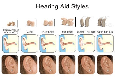 Style of Hearing aid devices.